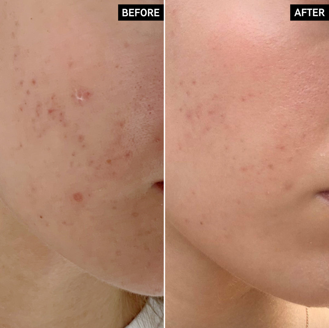 The Inkey List Mandelic Acid Treatment