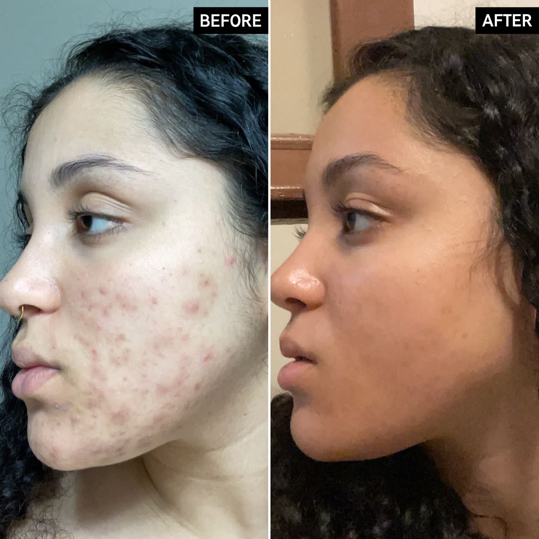 The Inkey List Tranexamic Acid Serum