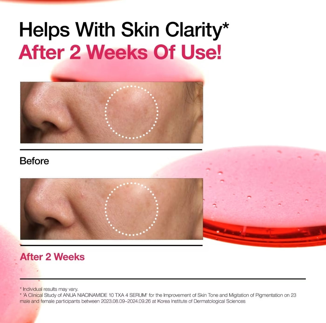 ANUA Niacinamide 10% +TXA 4% Dark Spot Correcting Serum