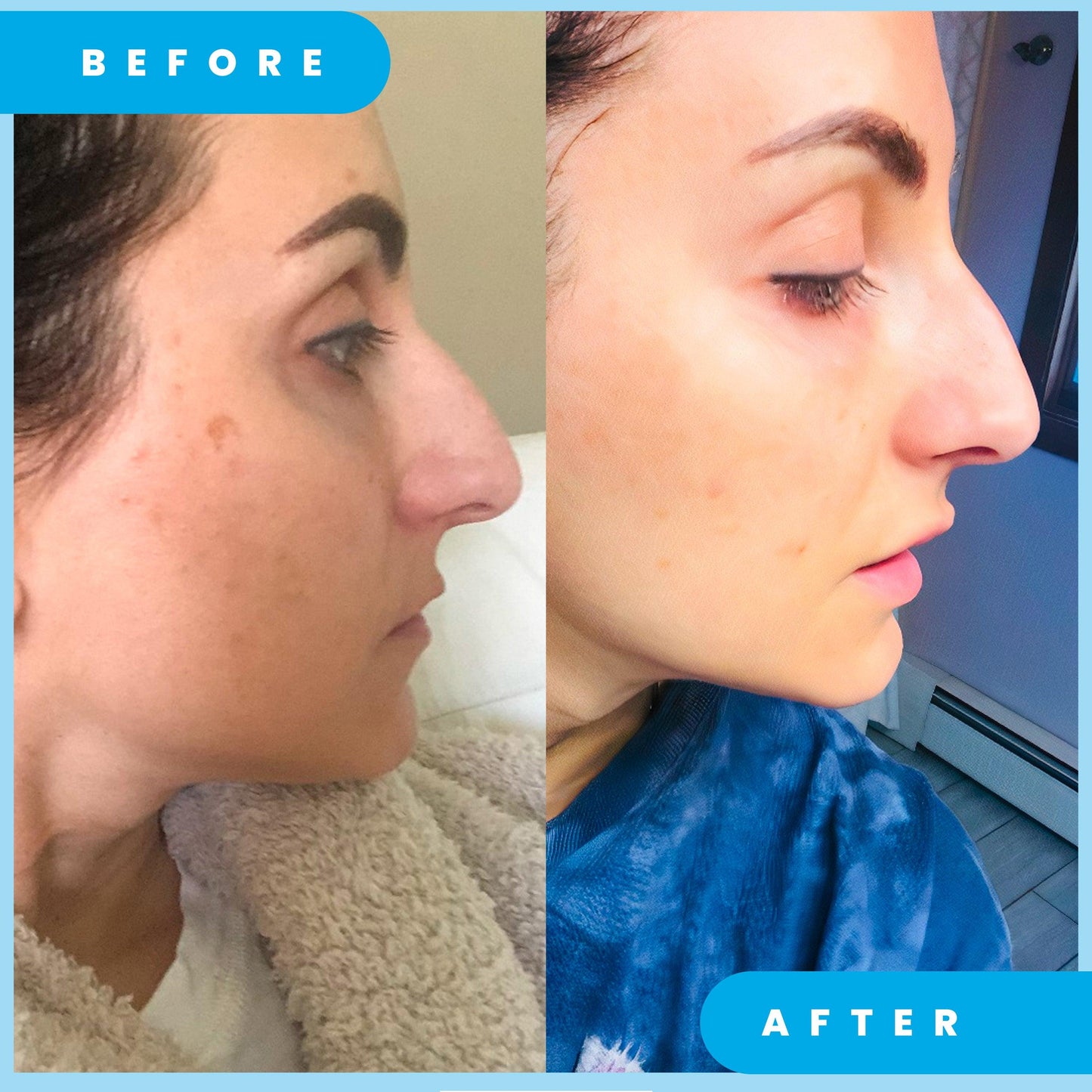ADMIRE MY SKIN Ultra Potent Brightening Serum For Dark Spots & Uneven Skin Tone