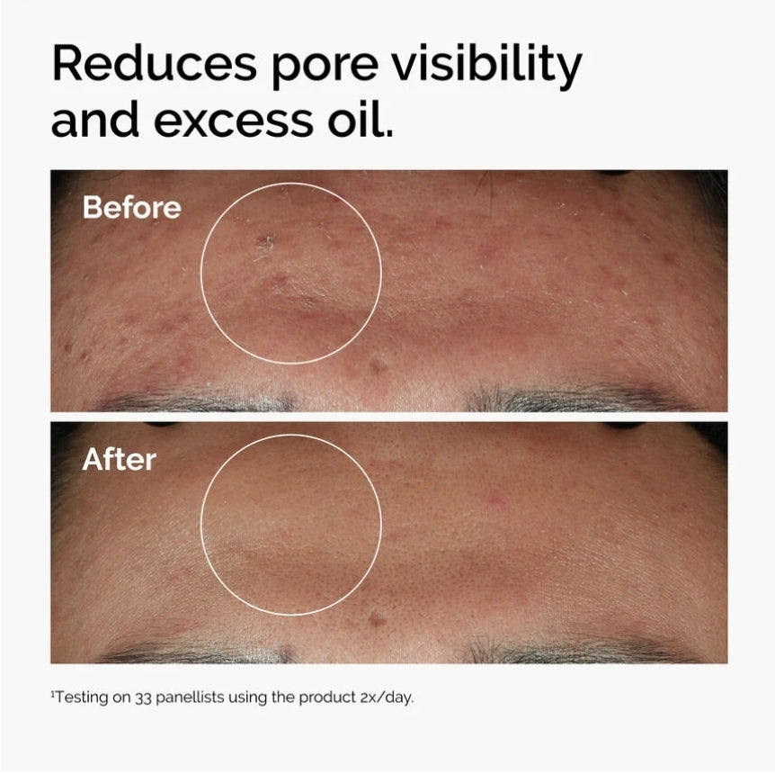 THE ORDINARY Niacinamide 10% Zinc 1% Serum 30ml