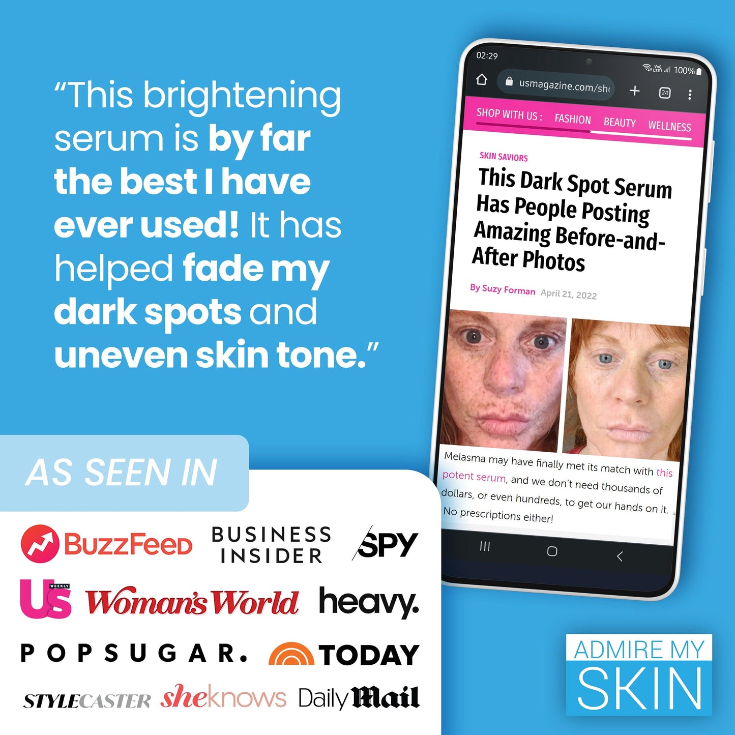 ADMIRE MY SKIN Ultra Potent Brightening Serum For Dark Spots & Uneven Skin Tone