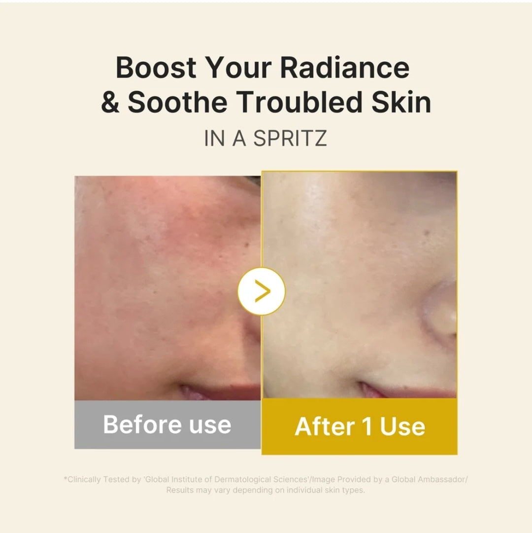 MEDICUBE Kojic Acid Turmeric Jelly Mist Serum